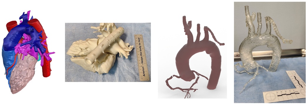 Anatomical Models