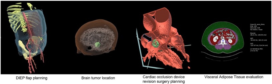 Virtual Reality and Advanced Visualization with Arial