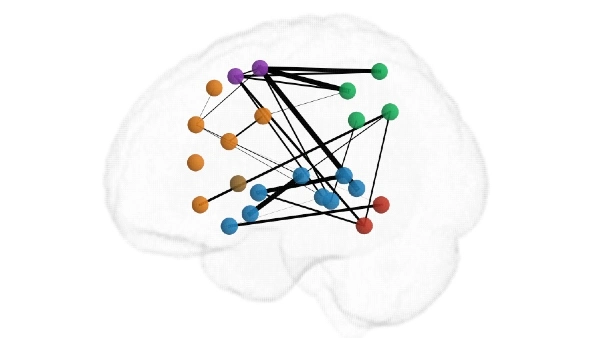 Diagram of a brain with colorful points connected in a network