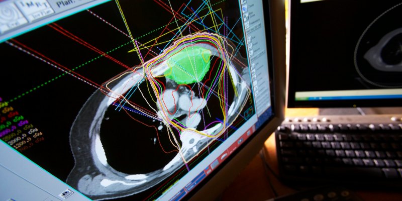 Thoracic scan on monitor
