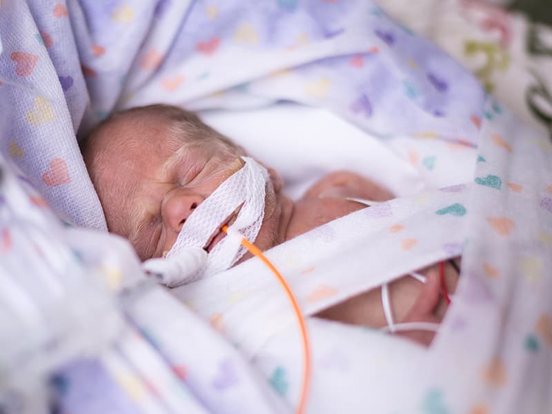 Newborn baby with a feeding tube