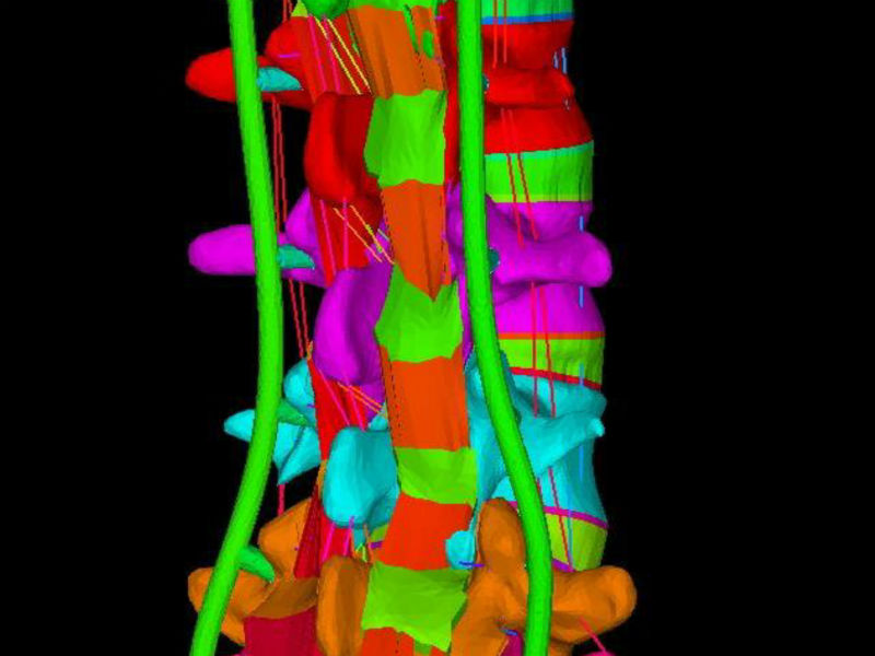 Model of a lumbar spine