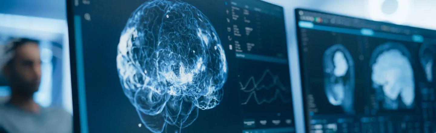 Computer monitors showing brain MRI imaging