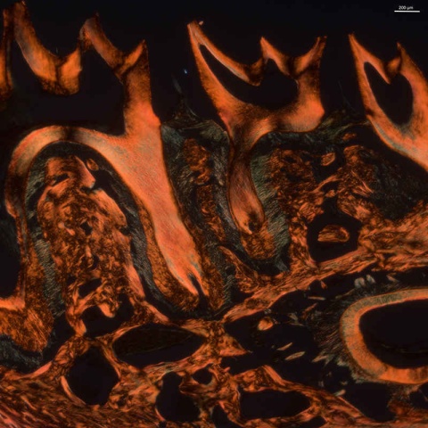 Polarized microscopy image of picrosirius red stained mouse mandible sections from Hyp mice, a model of X-linked hypophosphatemia (XLH). Image courtesy of Delia Alkhatib.