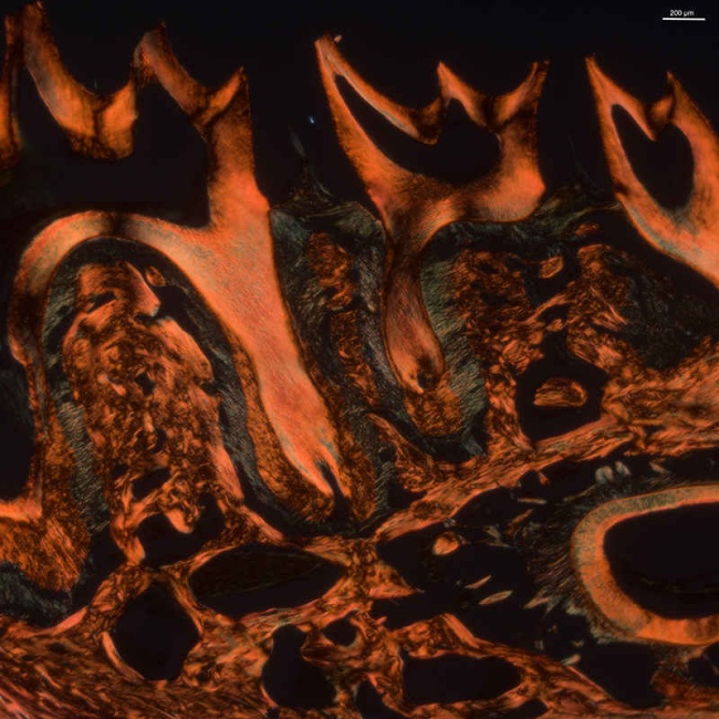 Polarized microscopy image of picrosirius red stained mouse mandible sections from Hyp mice