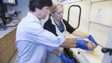 A Way to Withstand Alzheimer’s Disease is in Sight